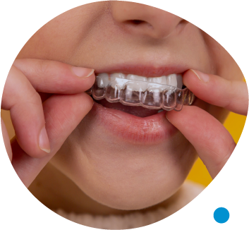 https://morthodontics.care/wp-content/uploads/2023/07/Invisalign.png